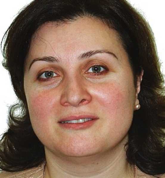 Dr. Lali Chania 